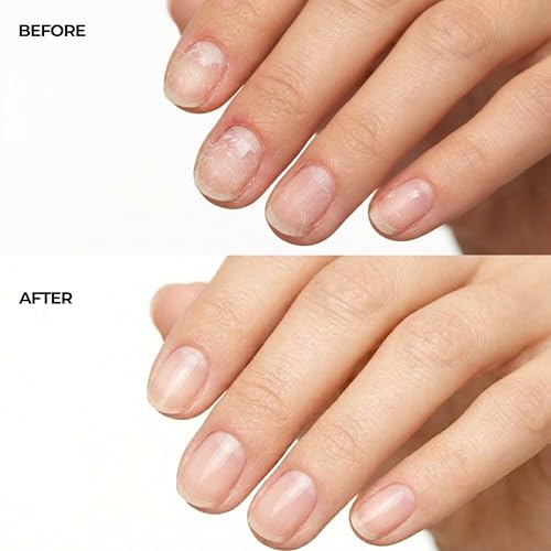 Fast-Absorbing Nail Strengthener for Weak, Thin & Post-Acrylic Damaged Nails - Perfect for Frequent Handwashing - Niacinamide, Keratin, Hyaluronic Acid & Peptides - 45 Day Supply by nakeyNails