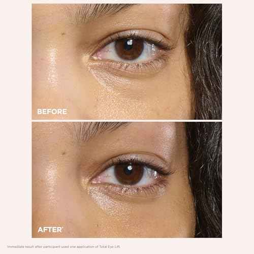 Clarins NEW Total Eye Lift | Anti Aging Eye Cream | Targets Wrinkles, Crow's Feet, Dark Circles and Puffiness For a Visible Eye Lift in 30 Seconds | REFILLABLE