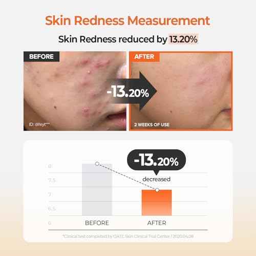 SKINFOOD Carrot Carotene Calming Water Toner Pads, Korean Skin Care Toner Pad for Face, Deep Hydrating, Soothing, After Sun Skincare for Sensitive Skin, Redness Relief, 100% Cotton, 8.81 oz (60 Pads)