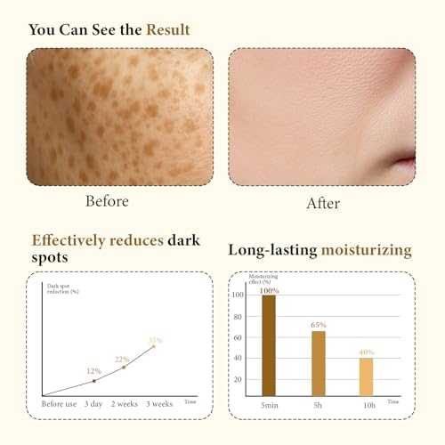 2 Pcs Pores Dark Spots Cream - Arbutin, Tranexamic Acid, Niacinamide | Targets Spots, Pore Minimizing, Radiant Glow, Gentle Hydrating Formula | Hyperpigmentation Cream for All Skin, 1.76 Fl Oz