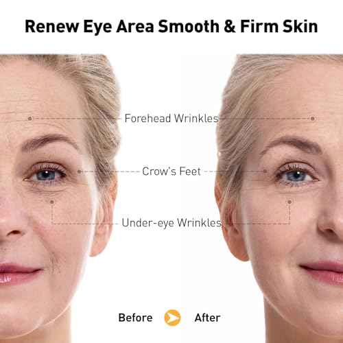 Retinol Eye Cream for Anti-Aging & Wrinkles ? Firming, Hydrating & Repairing Eye Serum with Niacinamide, Hyaluronic Acid, Vitamin E & Bifida Ferment Lysate, 0.7 Fl Oz (Pack of 1)