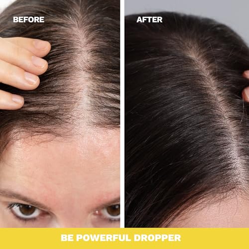 Ginger Root Extract | Growth Stimulating Drops and Hair Loss Control | Serum Vegan Energizing Hair Elixir | Be Powerful (4 fl oz)