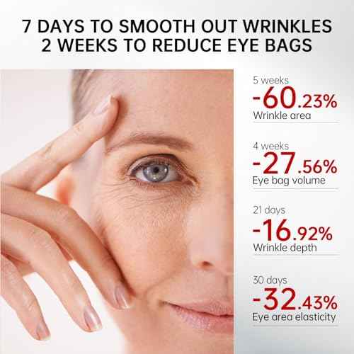 Retinol & Caffeine Eye Serum -360¡Æ Massage Roller for Puffiness,Eyebag Remover,Wrinkle Filler,Under Eye Cream For Dark Circles 0.54fl.oz (Pack of 1)