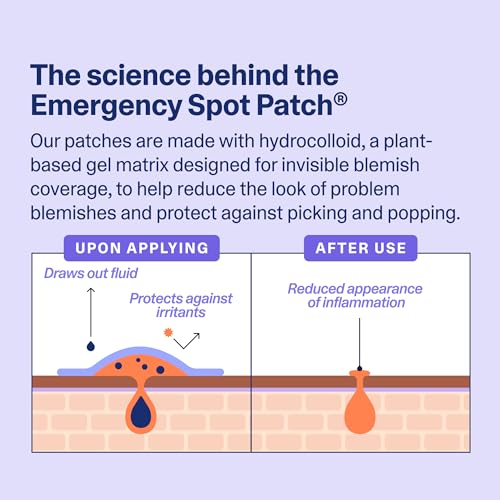 Curology Emergency Spot Pimple Patches for Face, Hydrocolloid Pimple Patches Fast-Acting, 40 Count