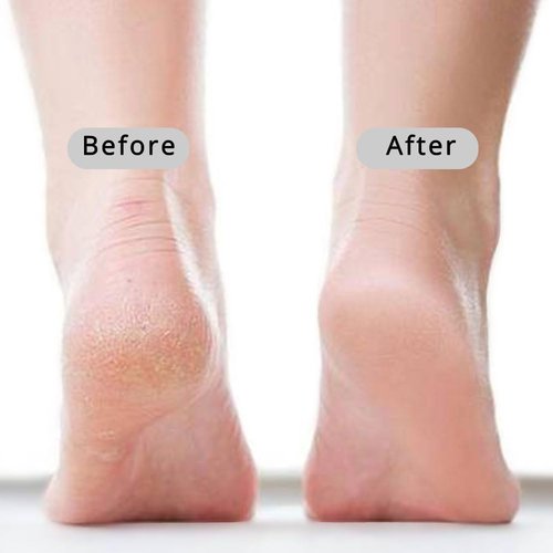 Copesfuda Straight Handle Pumice Stone - Professional Firm Control Foot Scrubber for Stubborn Calluses - Natural Dead Skin Remover & Pedicure File for Feet and Hands - 14“