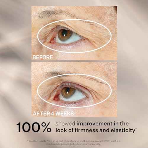 StriVectin Tighten & Lift Peptight Face Lift Serum with Tightening & Brightening Peptides for Wrinkles