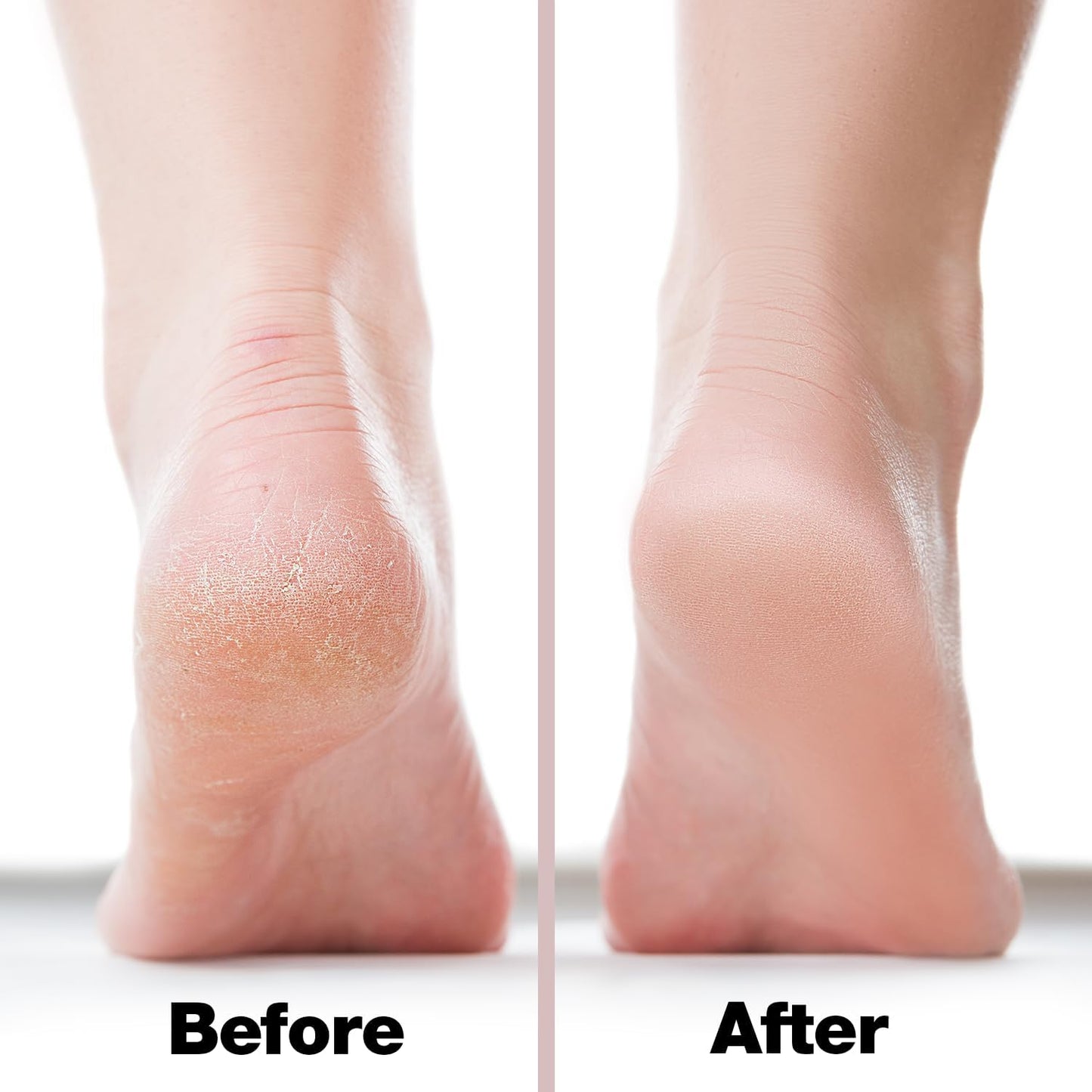 Probelle Double Sided Multidirectional Nickel Foot File Callus Remover - Immediately Reduces calluses and Corns to Powder for Instant Results, Safe Tool (Dark Grey)