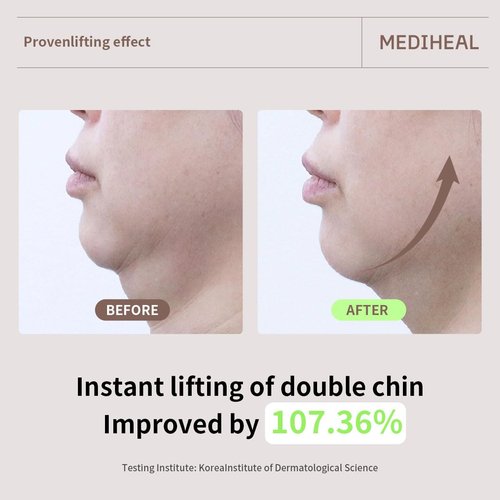 Mediheal Retinol Collagen Cream Lifting Mask | Anti-Aging V-Line Treatment - 10 Count Pack