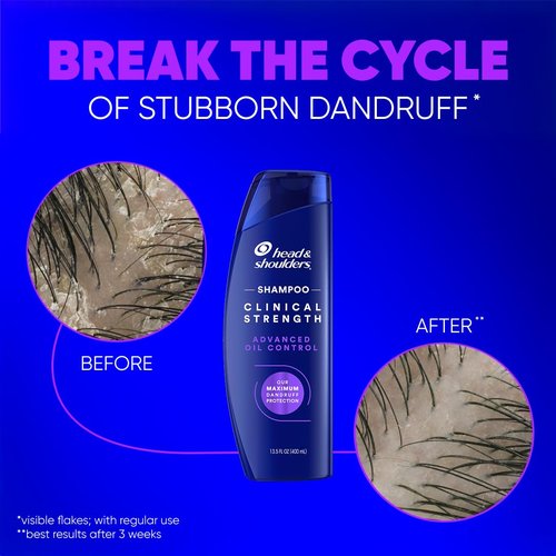 Head & Shoulders Dandruff Shampoo - Clinical Strength Oil Control Formula for Flake Protection | 13.5 Fl Oz