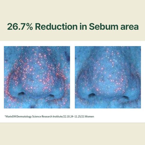 Pyunkang Yul Calming Moisture Serum - Daily Hydration & Skin Soothing with Centella Asiatica, Tea Tree & 5 Hyaluronic Acids