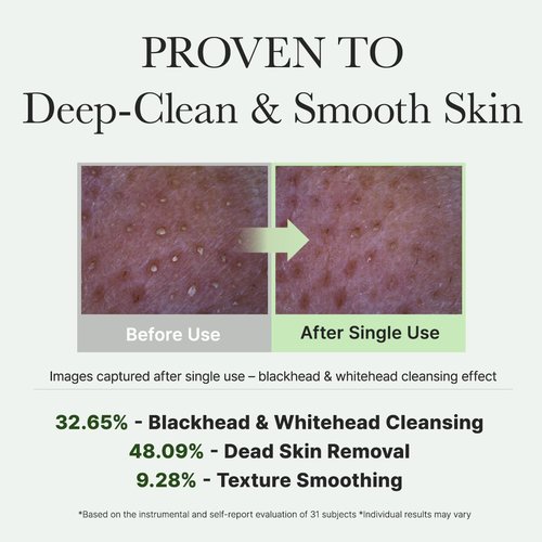 ARENCIA Korean Rice Mochi Face Cleanser - Gentle All-in-One Face Wash for Deep Cleansing & Moisturizing | Acne-Prone Skin
