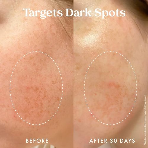 Kopari Star Bright Vitamin C Moisturizer - Lightweight Formula with Starfruit & Niacinamide, 1.7oz | Brightens & Evens Skin Tone