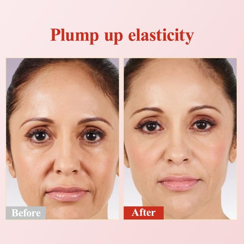 HKH Pro-Retinol Face Serum Capsules - Anti-Aging & Anti-Wrinkle Skincare - 96 Capsules with Vitamin A & E for Smooth, Hydrated Skin