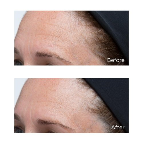 Perricone MD Hyaluronic Intensive Moisturizer - Ultra Hydrating Face Cream for Smooth, Plump Skin
