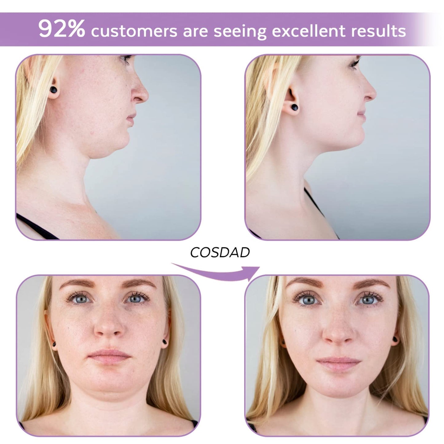 COSDAD Reusable Double Chin Reducer Chin Strap Face Slimming Strap Face Slimmer Shaper for Women,Breathable Comfortable V Line Lifting Mask,Innovative Lifting Technology,One Fits All,Purple