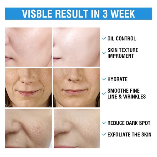 BACHERI Glycolic Acid & Salicylic Acid Peel Pads - Exfoliating Resurfacing Facial Treatment, 55 Pcs