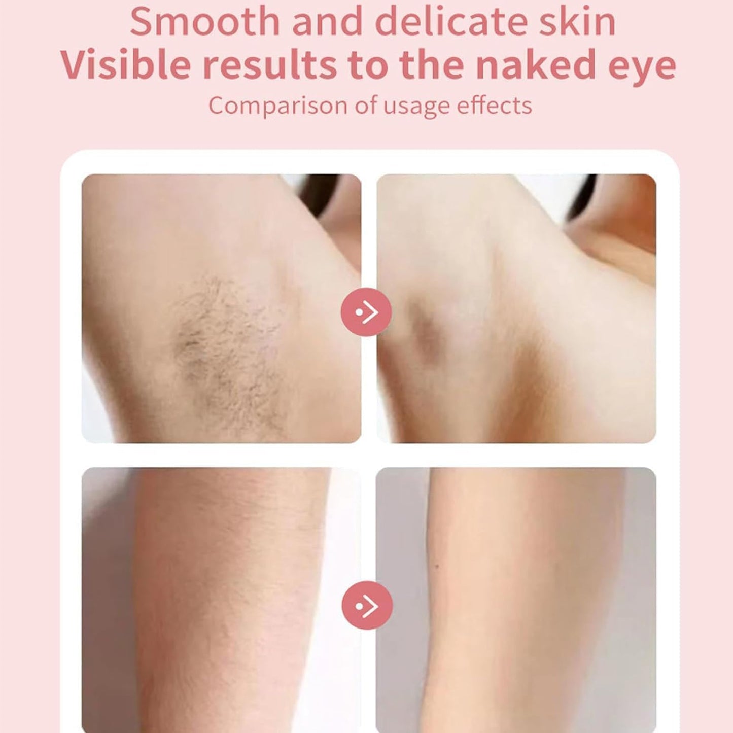 3 in 1 Livora Electric Shaver for Women, LED Display Solys Razor for Women, Slickglide Pro Electric Razor, BeautiBloom, Rechargeable Trimmer for Bikini, Portable, Waterproof, Legs, Body, Wet/Dry