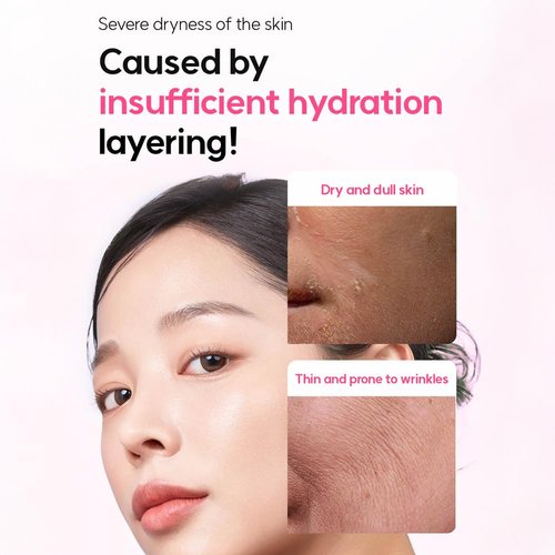 Elishacoy | Moist Up Super Hyalurone Serum - Deep Hydration & Elasticity Booster with Hyaluronic Acid & Collagen | 50ml
