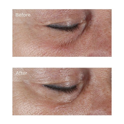 Perricone MD Firming Eye Cream - Hypoallergenic Formula for Youthful Skin | 0.5 oz