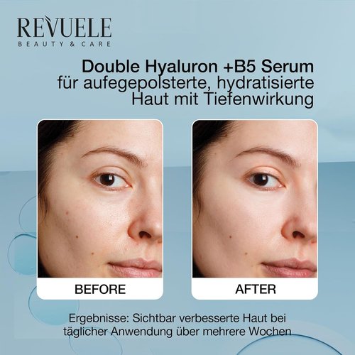 Revuele Double Hyaluron + B5 Serum - Hydrating Face Serum with Hyaluronic Acid & Panthenol | 1 fl. oz