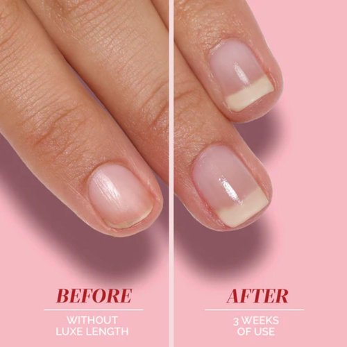 LONDONTOWN Nail Strengthener & Growth Treatment - Repair, Shine & Protect Weak Nails - Clear Formula