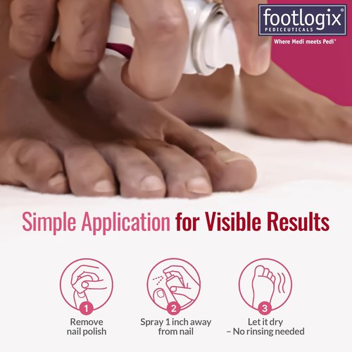 Footlogix Nail Tincture Spray - Spiraleen Formula for Healthy Nails | 1.55 Fl Oz