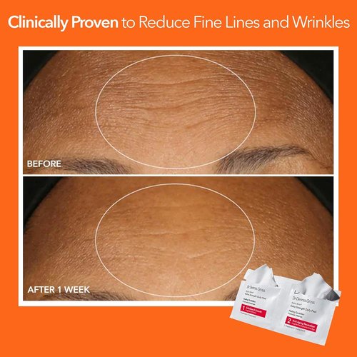 Dr. Dennis Gross Alpha Beta Daily Peel - Extra Strength for Oily Skin, Uneven Tone & Wrinkles (30 Treatments)