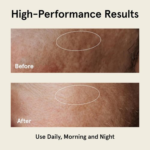 JAXON LANE Relax And Repair Anti-Aging Face Moisturizer for Men - Night Cream with Niacinamide & Hyaluronic Acid