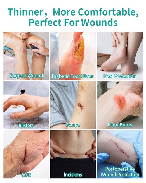 New Hydrocolloid Roll,2in*5ft Hydrocolloid Bandages for Wound Care,Medical-Grade Hydrocolloid Patch Bandages with Self-Adhesive, Flexible & Waterproof DIY Size & Shape (5FT)
