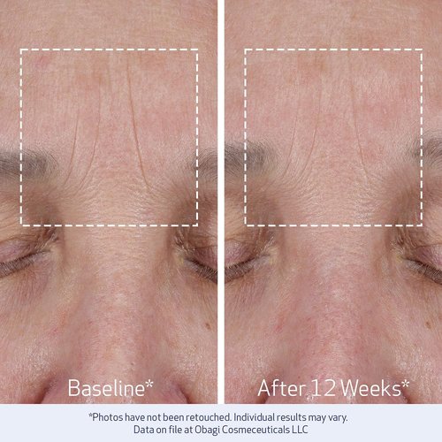 Obagi ELASTIderm Lift Up & Sculpt Facial Moisturizer - Clinically Proven Anti-Aging Cream for Firming & Smoothing - 1.7 oz