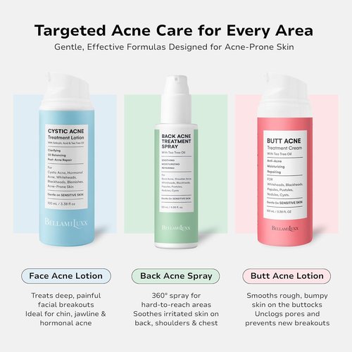 Cystic Acne Treatment for Face: Hormonal Acne Treatment Cream for Teens & Adults - Salicylic Acid & Tea Tree Oil Pimple Spot Remover - Anti-Acne Moisturizer Reduces Redness, Blemishes