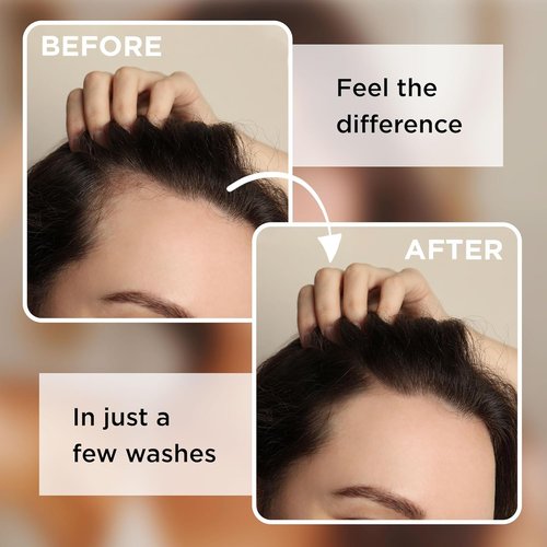 Rice Water Shampoo Bar - Nourishing Citrus Scent Shampoo with Cocoa & Shea Butter for Hair Growth - 3.5 Oz