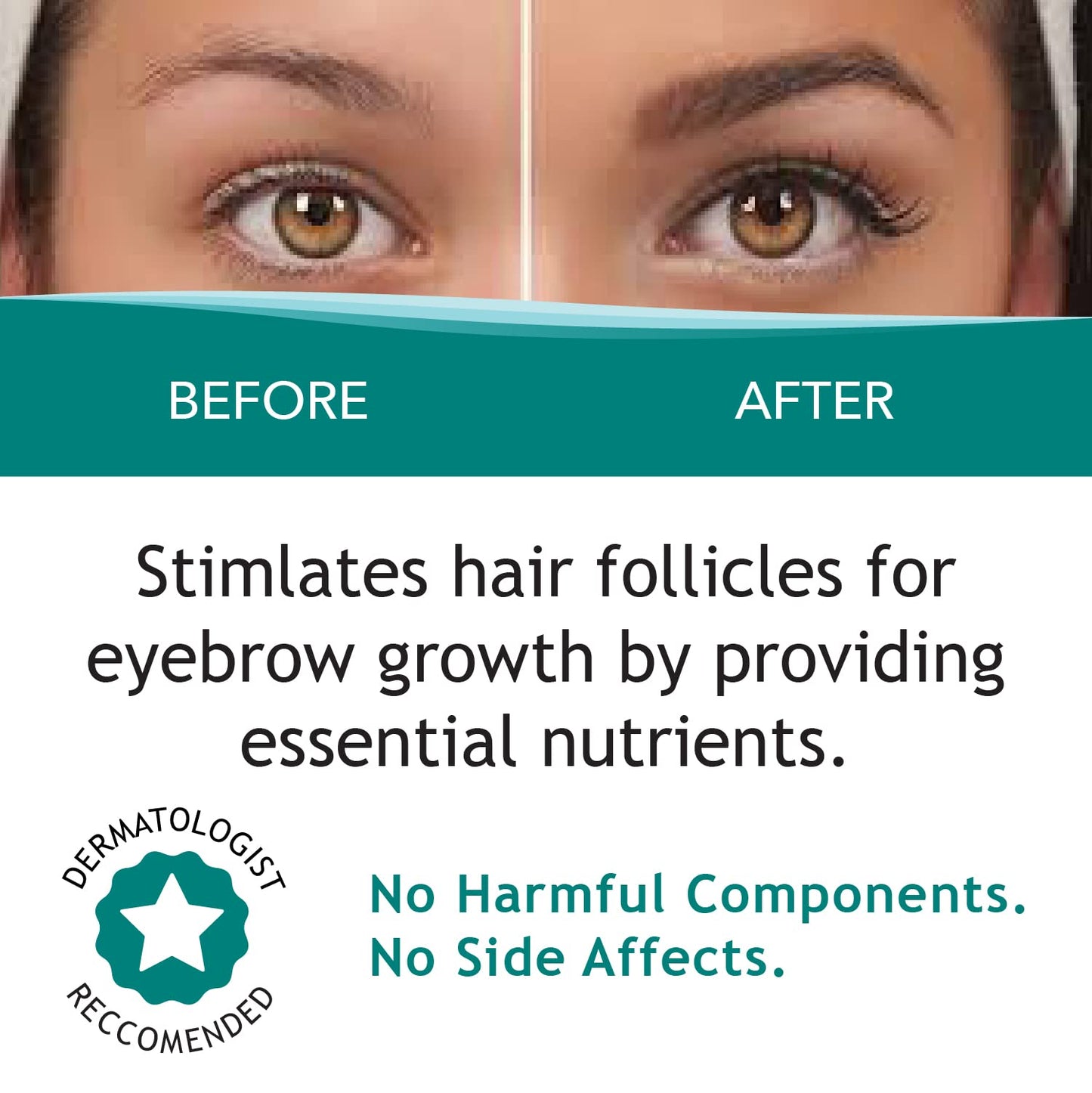 FEG Max Eyebrow Enhancer Growth Treatment Serum | Eyebrow Enhancing Serum to Help Lengthen and Thicken Eyebrows | Non-irritating Brow Serum | 6ml