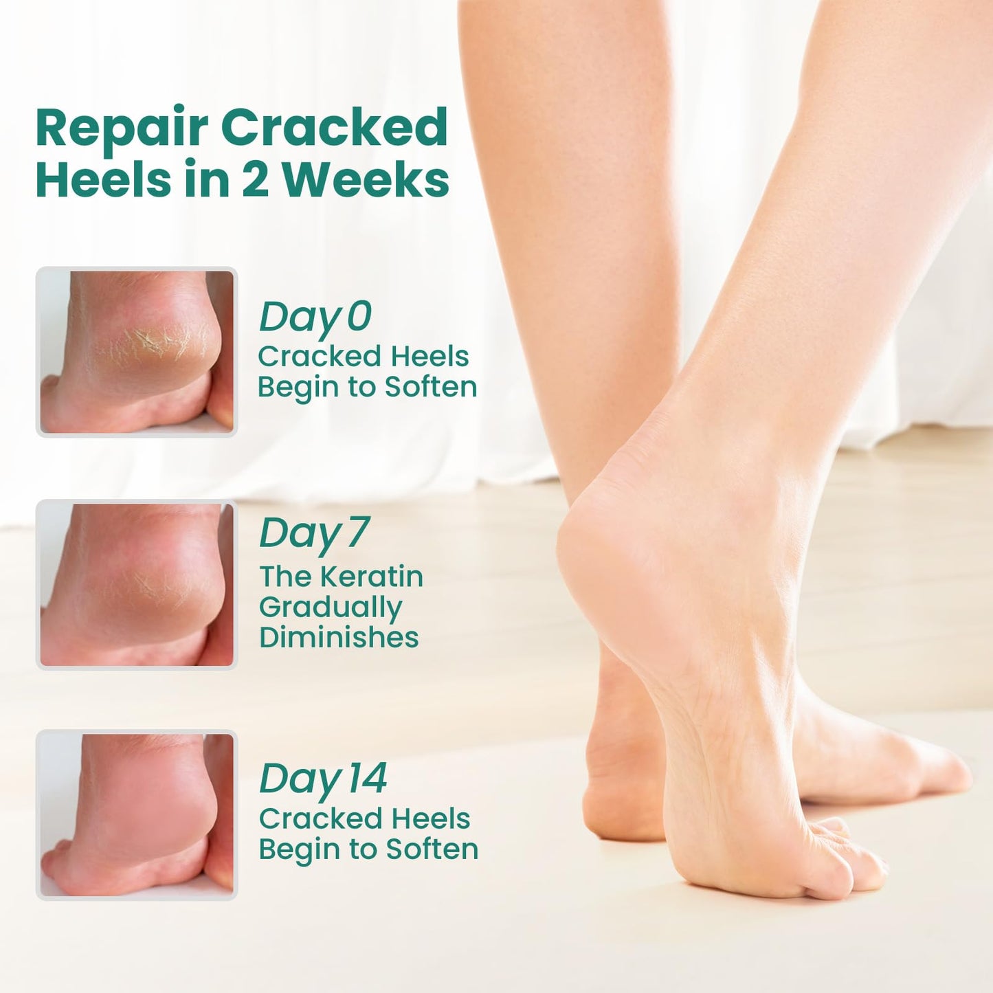 Welnove Moisturizing Heel Socks - 2 Pairs Aloe Vera Extract Infused Gel Lining for Dry Feet - Cracked Heel Repair Treatment - Cotton Socks for Women Men Foot Care (Pink, Extra Large)