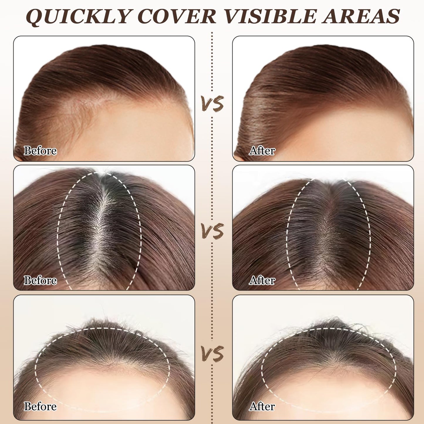 Nicgou Maycheer Hairline Shadow Powder, Maycheer Hair Shadow Root Cover Up, Maycheer Hair Shadow, Hair Line Concealer Root Cover Up, Unisex Root Touch Up Hair Powder (Light Brown, 03)