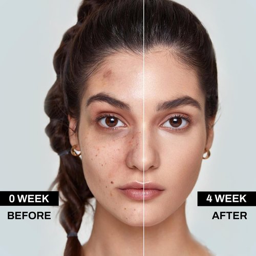 Dark Spot Remover for Face, Dark Spot Corrector - Age Spot Sun Spot Freckles Melasma Brown Spot, Natural Formula: Soothing and Repairing, Anti-Aging and Antioxidant Properties