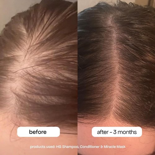 BONDIBOOST Anti-Thinning Shampoo - Clinically Tested for Fuller, Thicker Hair | 3.04 fl oz, Natural Mint Scent