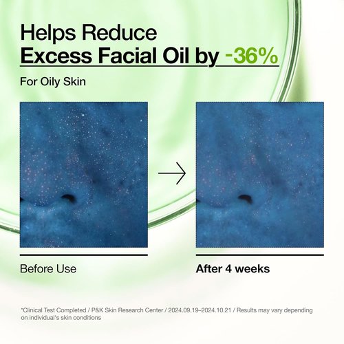 Anua Azelaic Acid 10% Serum - Redness Soothing Facial Serum for Blemish-Prone Skin | 1.01 fl oz