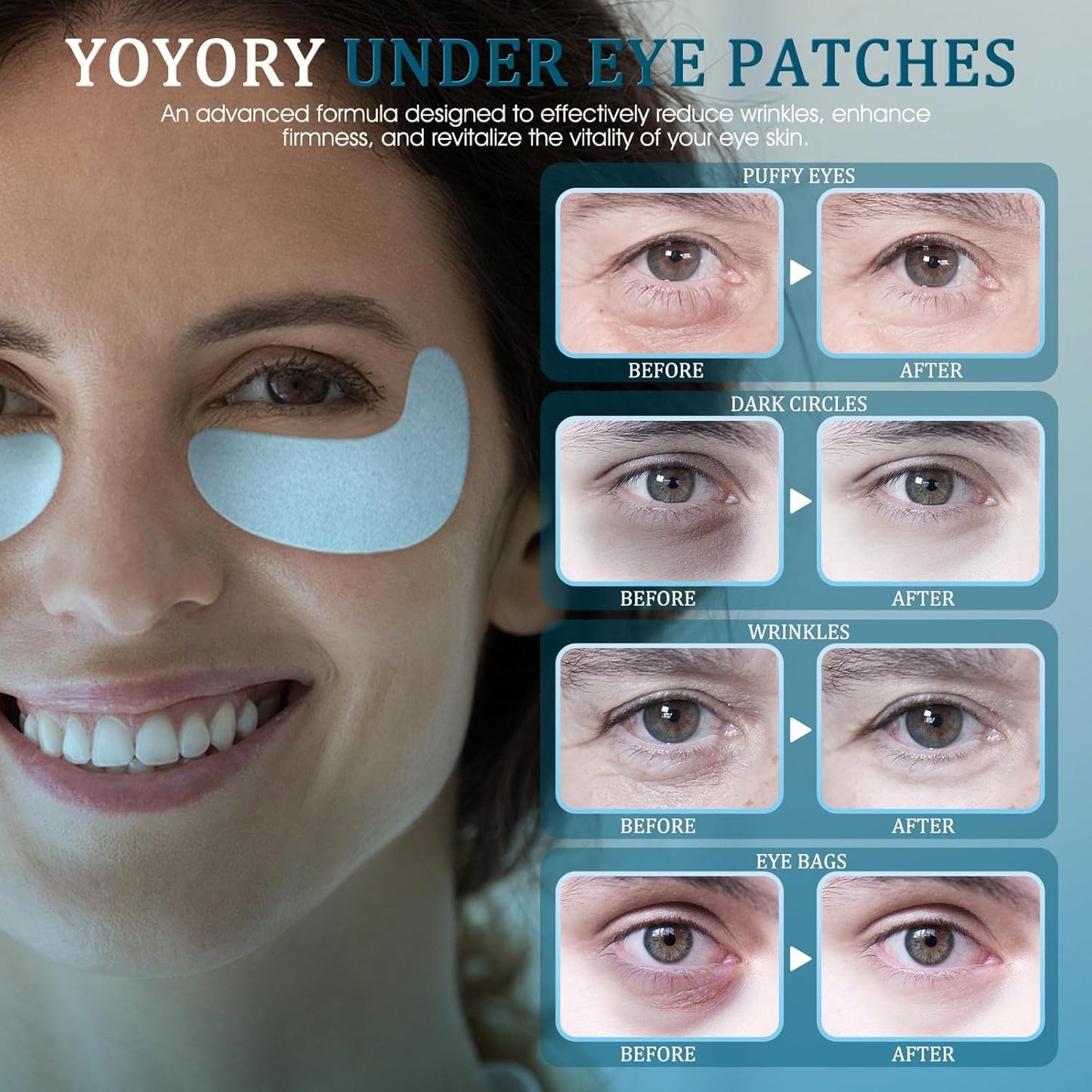 YOYORY Under Eye Patches - Eye Gel Masks for Wrinkles, Dark Circles, Puffy Eyes, Fine Lines, Eye Bags Treatment with Hyaluronic Acid Collagen Moisturizing Hydrating 15 Pairs,White