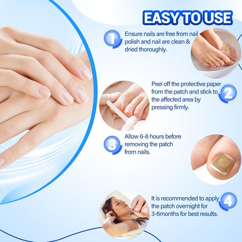 Regine Switzerland Toenail Fungus Treatment - 50 Extra Strength Hydrogel Nail Patches for Overnight Repair