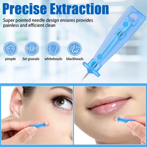 Sterile Needles for Pimples, 100Pcs Disposable Acne Needles Effective Blemish and Blackhead Removal Tools for Clear Skin