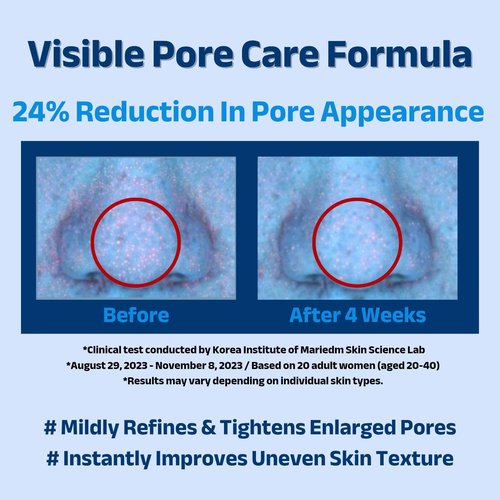 ACNIOME Pore-Care Gel Moisturizer - Lightweight Oil-Free Hydration for Oily & Sensitive Skin | 1.69 fl oz