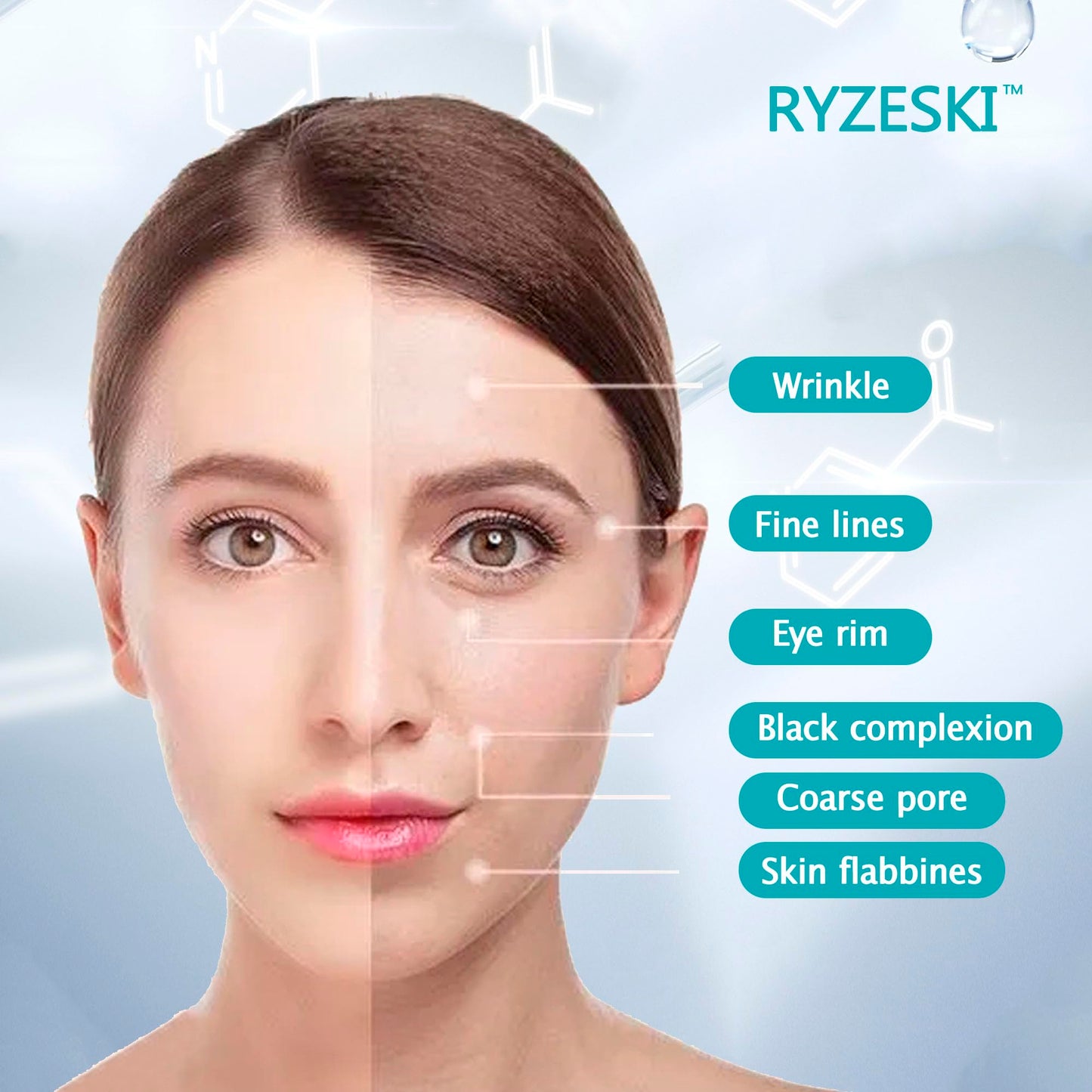 RYZESKI PDO Screw Thread, Improves Skin, Lift and Restore Skin Elasticity and Radiance, Pdo Thread Increase Firmness (20PCS-26G*60mm)