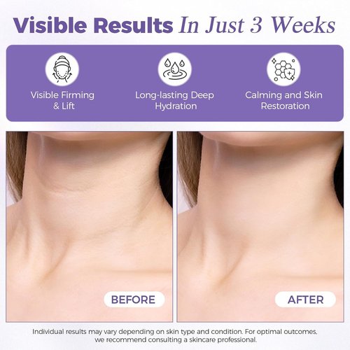 OUKEYA Retinol Lifting Neck & Face Cream - Peptide Firming Care with Hyaluronic Acid, Hydrating & Brightening