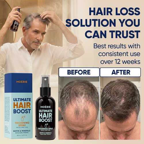 Moerie Hair Growth Serum Spray for Men and Women, Hair Loss Solution with Biotin and Rosemary, Thickening Serum for Hair Regrowth and Thinning Hair - Ultimate Scalp and Growth Care