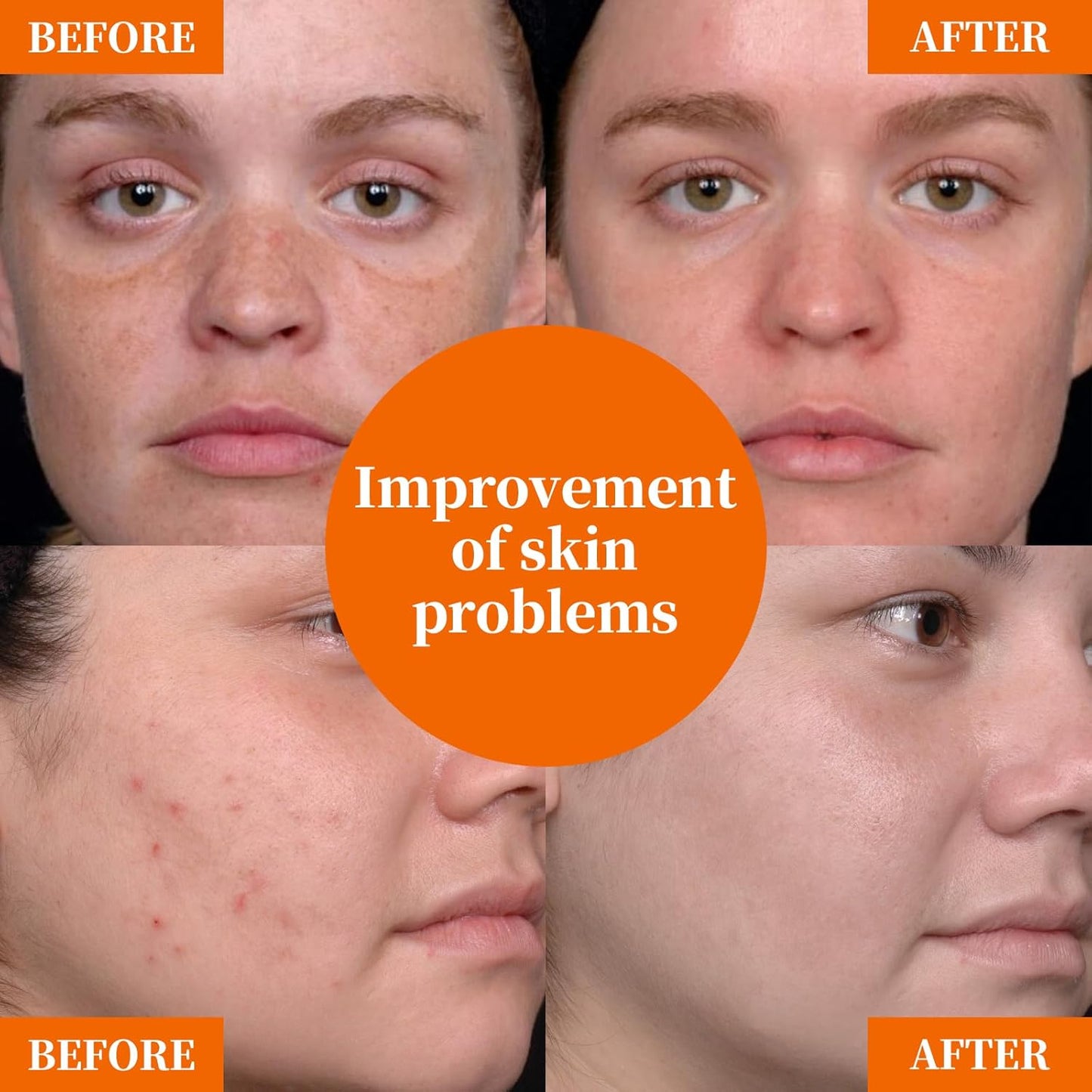 Skiennix Vitamin C Serum 20% - Anti-Aging & Hydrating Formula with Hyaluronic Acid | 1 Fl Oz