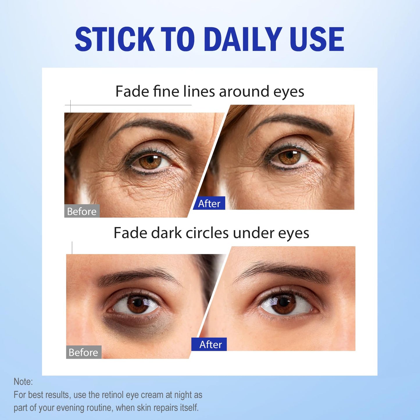 Retinol Eye Cream, Hydrating Under Eye Care Daily Wrinkle Cream, Infused with AHA30% to Smooth and Hydrate Skin, Eye Crea for Dark Circles Treatments, Reduce Under Eye Bags, Smooth Wrinkles(1.06 Oz)