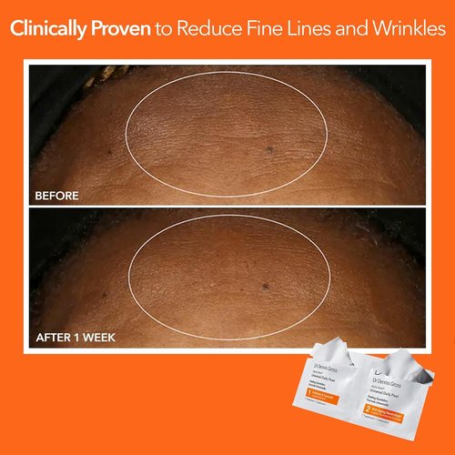 Dr. Dennis Gross Alpha Beta Universal Daily Peel - Smooth Uneven Tone & Texture | 60 Treatments