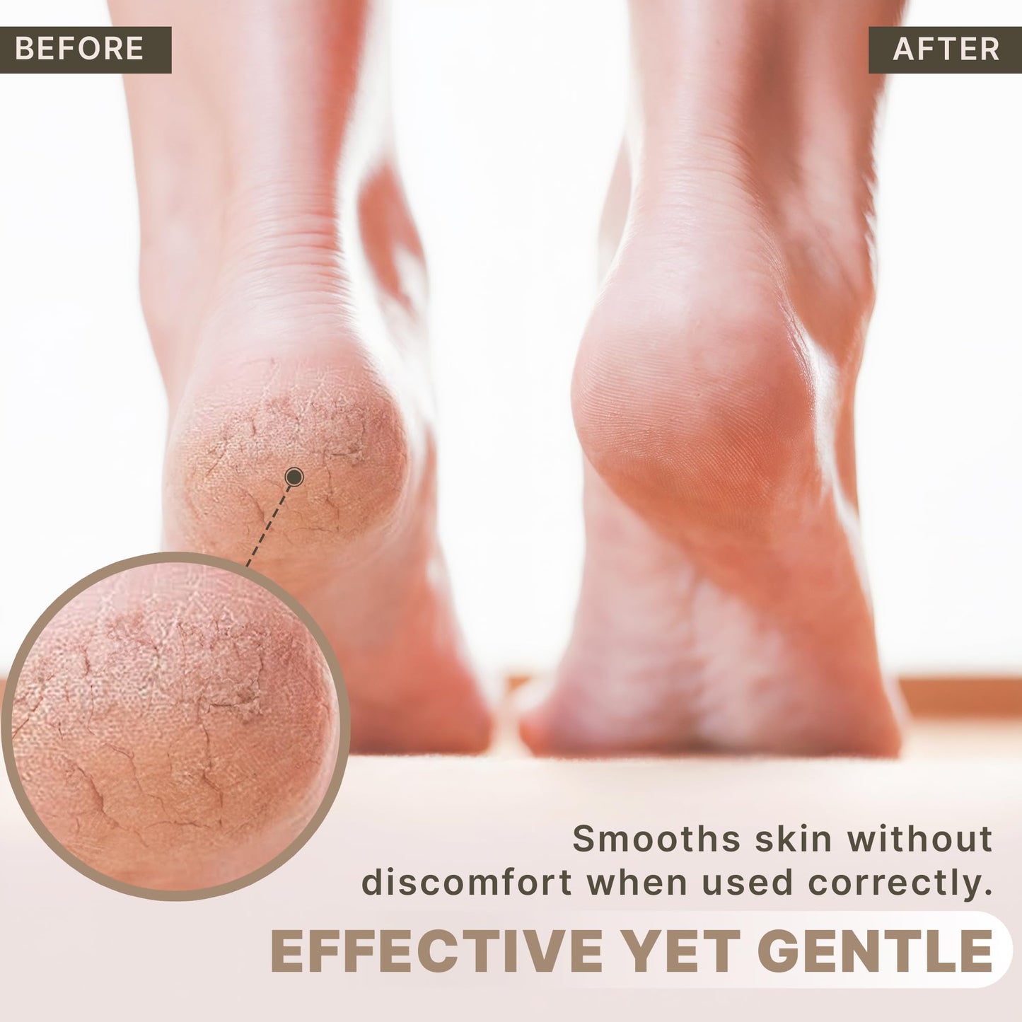 Pumice Stone for Feet - Natural Lava Stone Foot Exfoliator, Callus Remove for Feet, Hands & Dead Skin, Foot Scrubber for Pedicure & Cracked Heels, Strong & Durable Design for Smooth & Soft Feets