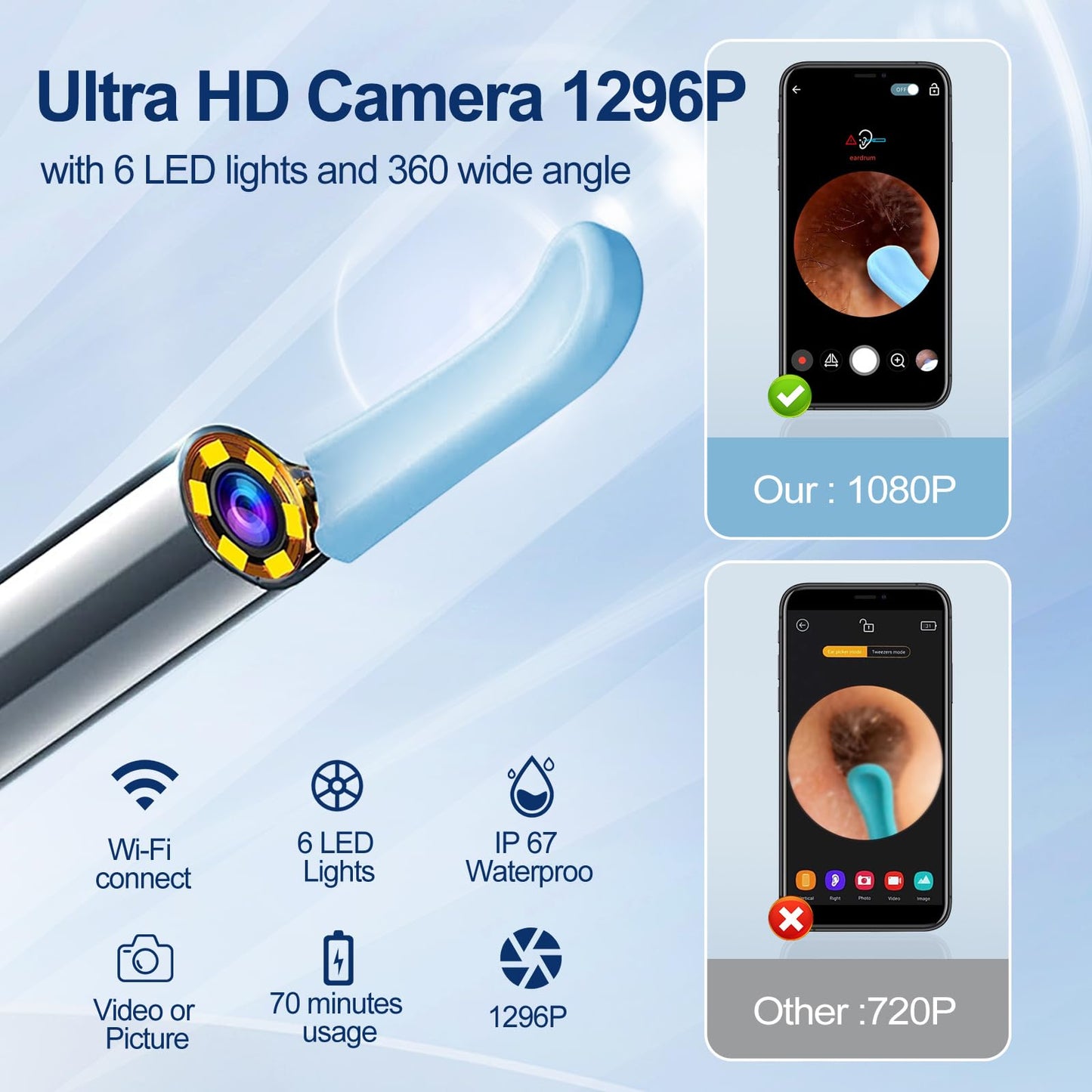 Ear Wax Removal, Ear Cleaner with Camera with 1296P, Earwax Removal kit with 9 Ear Pick and 8 Traditional Tools, Built-in WiFi IP67 Waterproof, Ear Cleaning Kit for iPhone,iPad,Android (White)